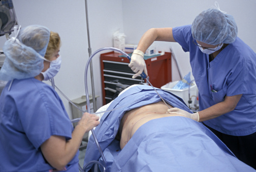 Liposuction Procedure - What To Ask Your Surgeon During The First Visit
