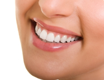 Benefits Of Dental Implants