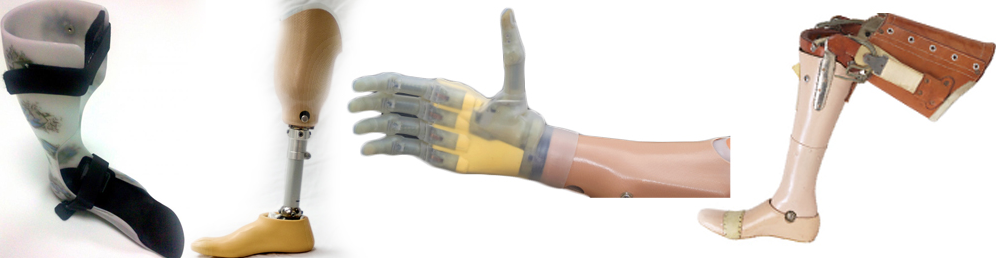 Revolution In Artificial Limbs: Brings Feelings Back To Amputees!