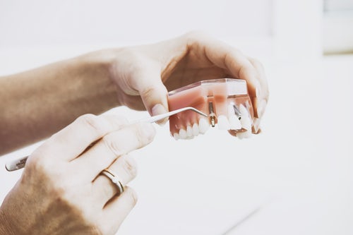 Everything You Wanted to Know About General Dentistry
