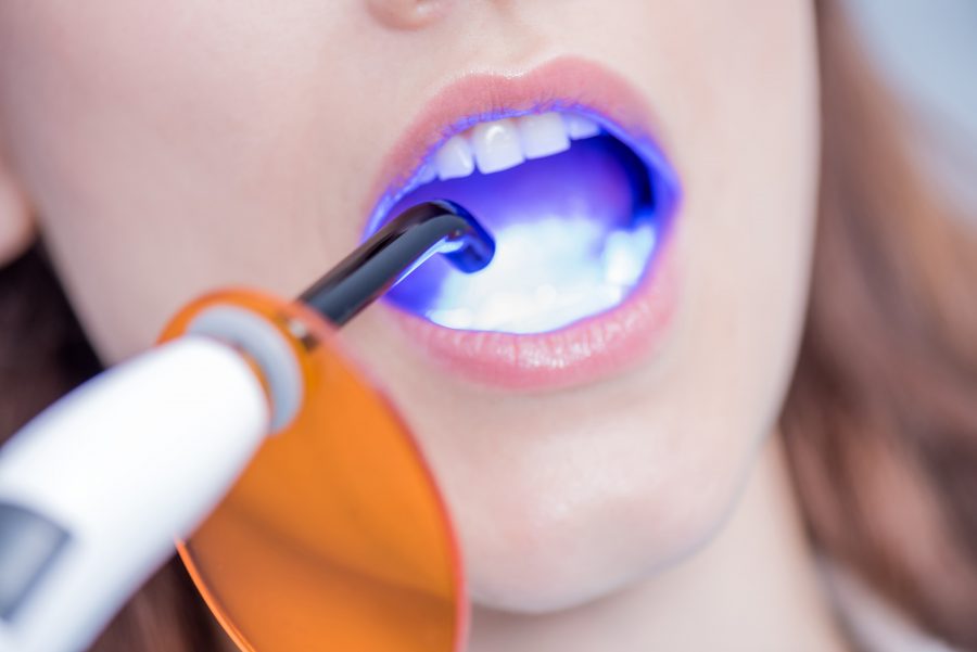 Dental Restorative Solutions For People With Damaged or Missing Teeth